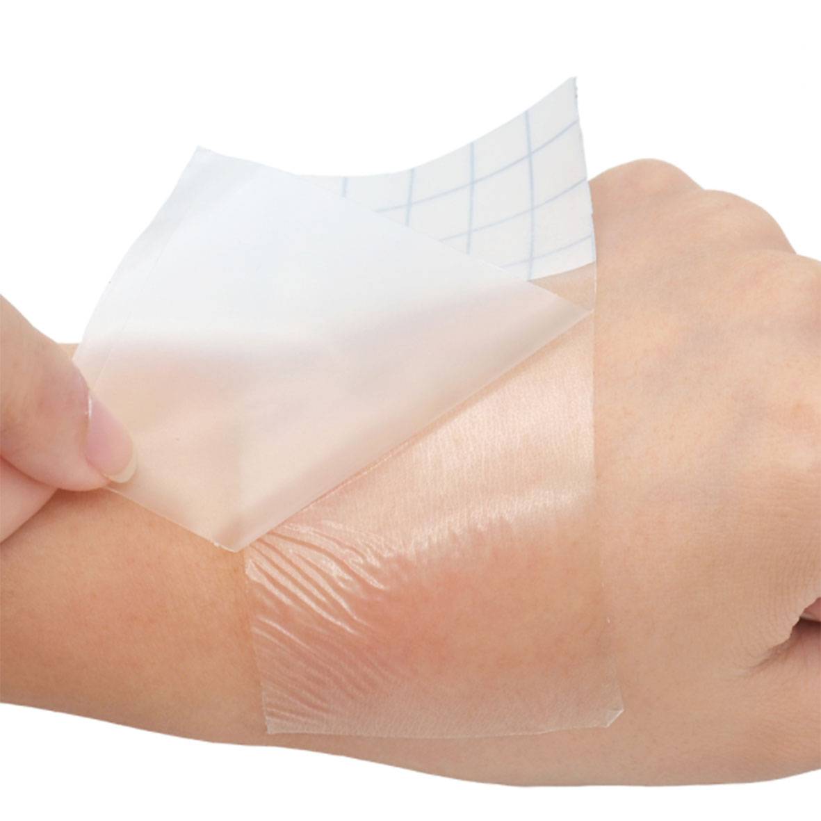 China OEM Mighty Patch Manufacturer –  Disposable PU waterproof medical Transparent wound dressing – Alps Medical