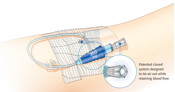 Antmed High Pressure IV Catheter Introduction