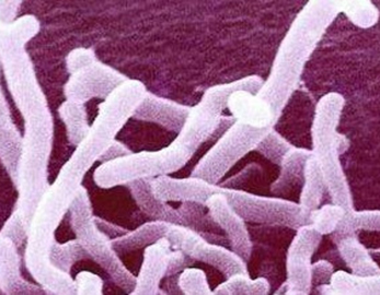 Bifidobacterium-Lactis