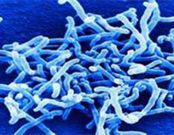 Bifidobacterium Longum