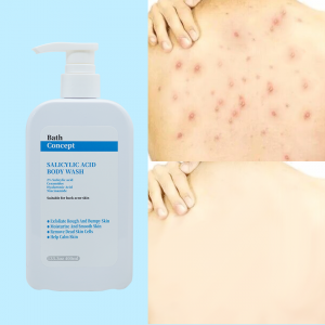 OEM Removing Back Acne Remove Dead Skin Cells Exfoliate And Hydrate Smooth Skin Body Wash