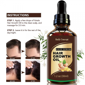 OEM/ODM ginger anti hair loss hair growth oil