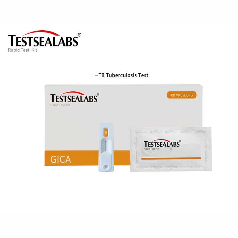 Testsealabs TB Tuberculosis Rapid Test Kit(whole blood, serum or plasma) Featured Image