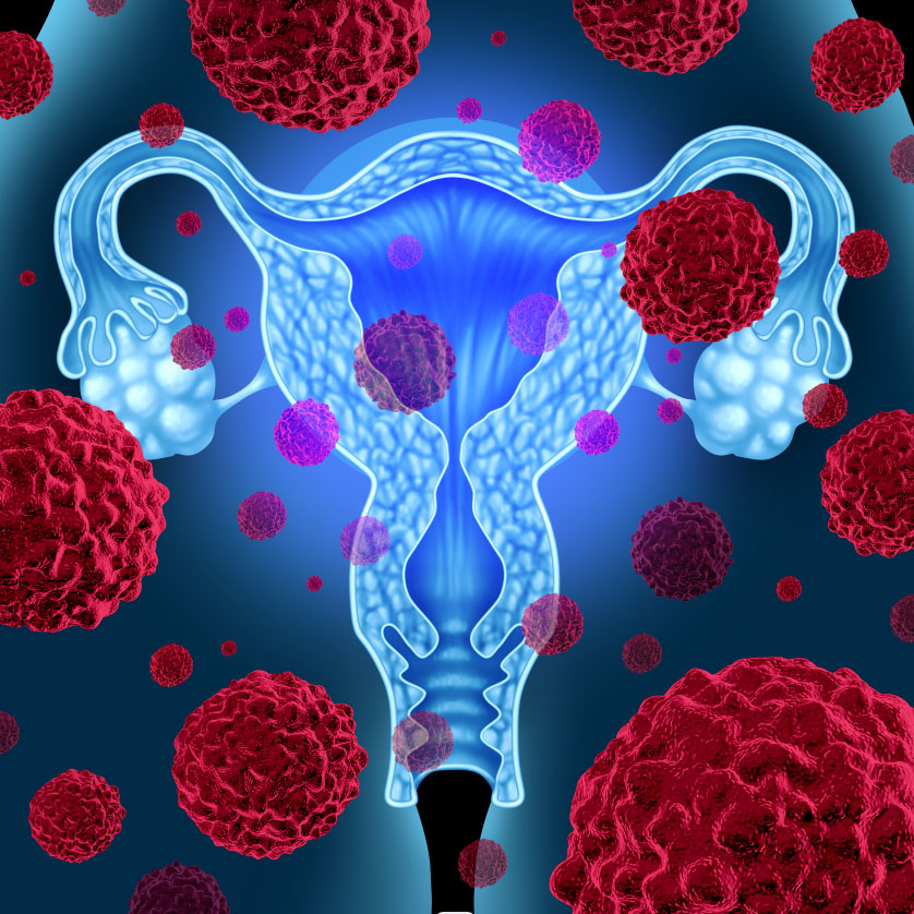 Cervix Cancer Featured Image
