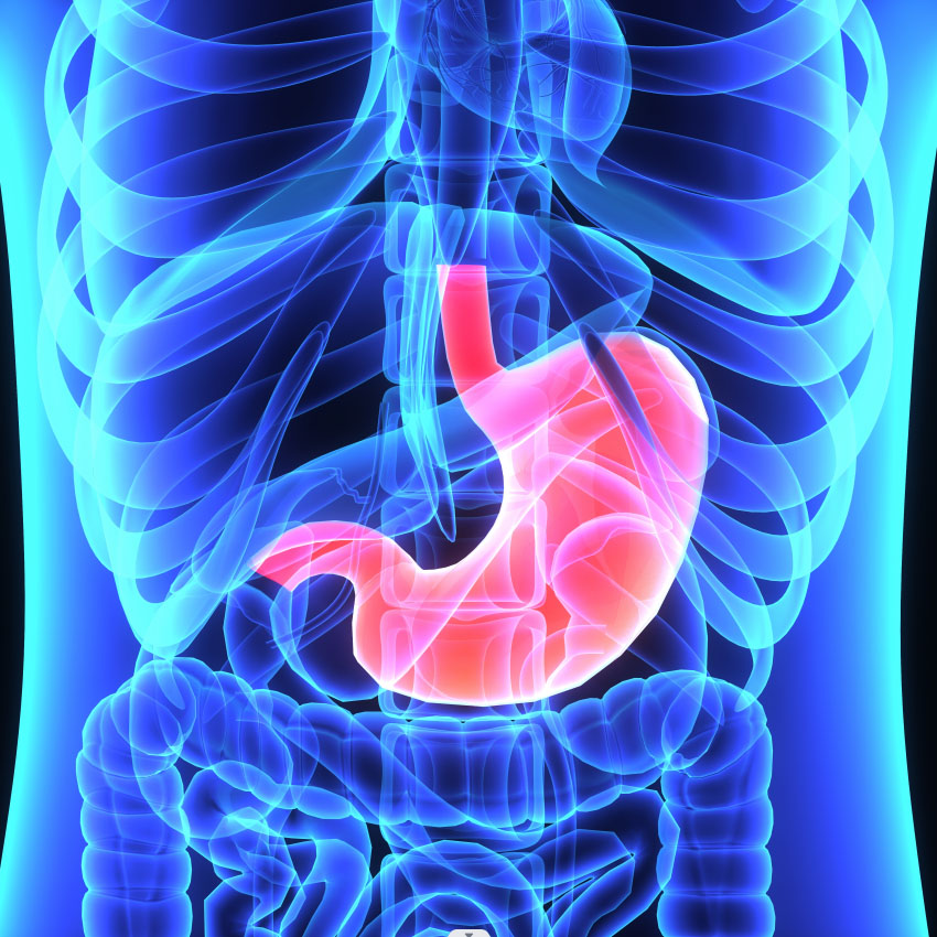 Digestive Tract Cancer