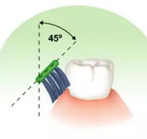 Cumu prutegge i vostri denti