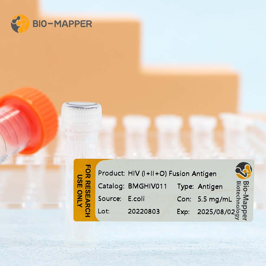 Buy Discount Legionella Pneumophila Antigen Test Kit Factory - HIV（rapid） – Bio-mapper