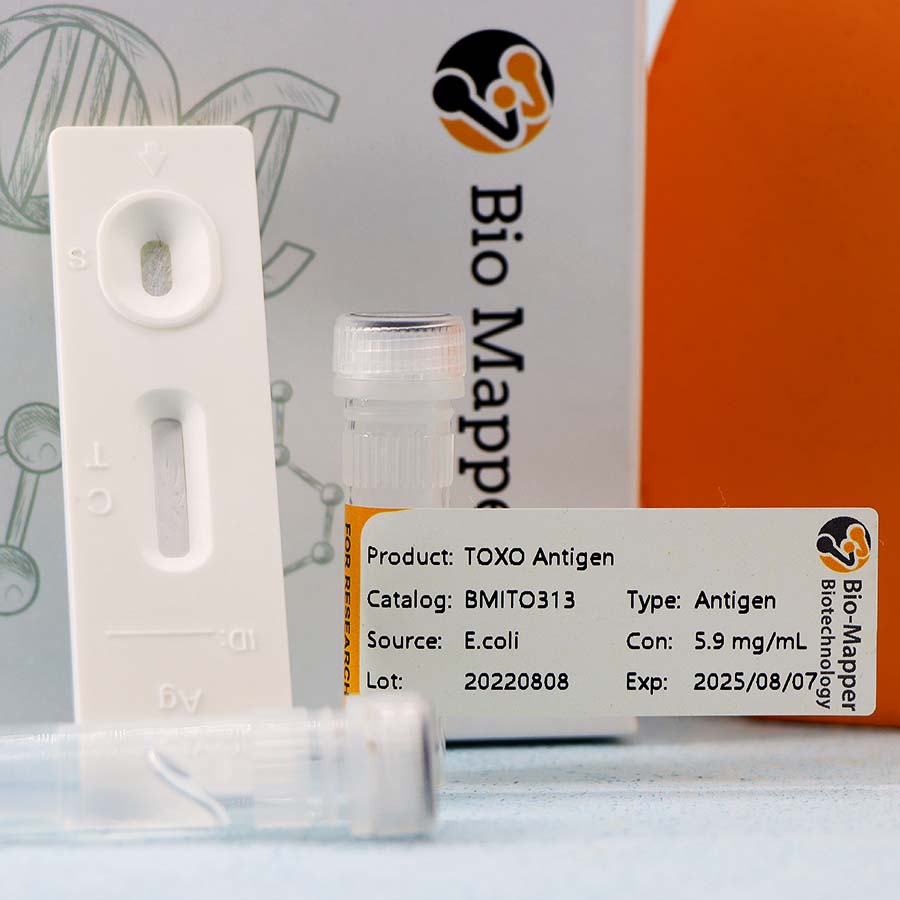 Wholesale  High Quality Rsv Antigen Test Kit Manufacturer -  Toxoplasma(CMIA) – Bio-mapper