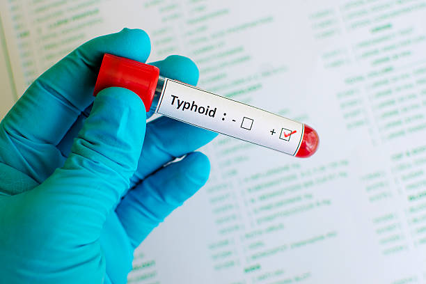 Typhoid: A challenging disease
