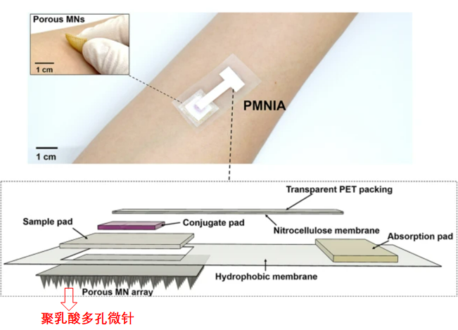 PLA porous microneedles: rapid detection of covid-19 antibody without blood samples