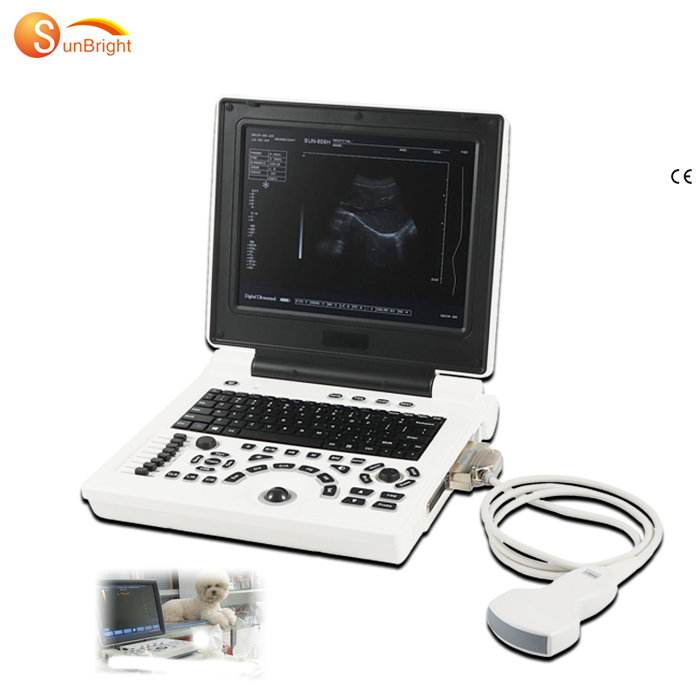 OEM Supply Kidney Ultrasound Cost - Medical ultrasound instruments CE Laptop 12 inch LED ultrasound SUN-806H – Sunbright