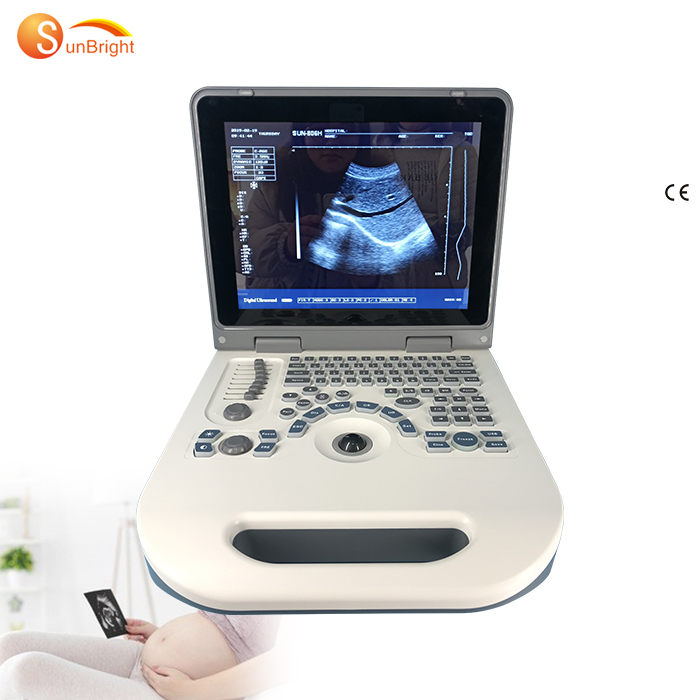 Popular Design for Free Ultrasound Clinics - cheapest ultrasound machine portable Ecograph Laptop Black and White Ultrasound SUN-806G – Sunbright