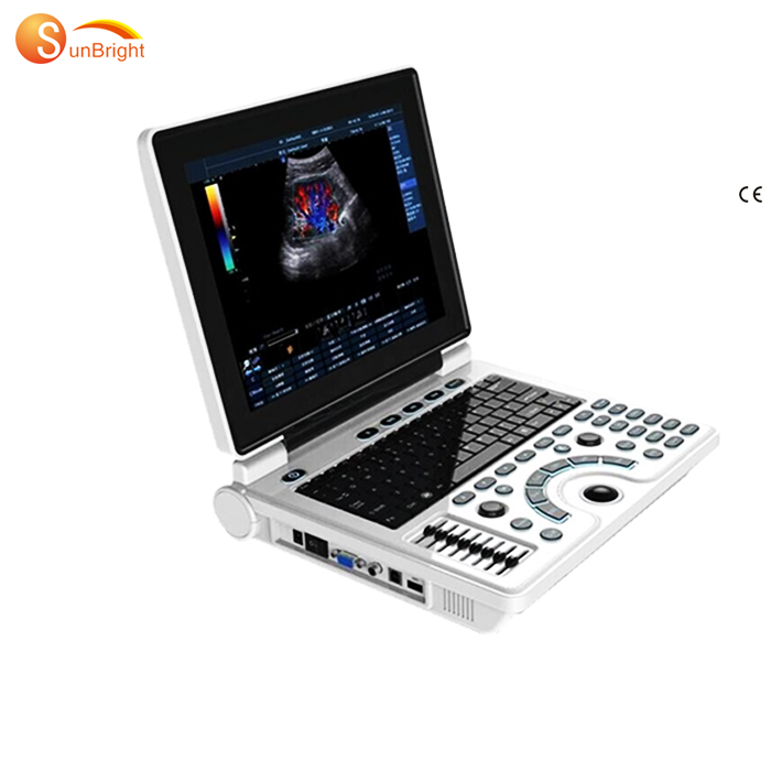 18 Years Factory First Ultrasound - New doppler ultrasound clinic hospital OBGYN baby scanner SUN-806H PLUS – Sunbright