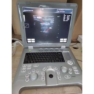 3D laptop ultrasound  for GYN, OB, Urology diagnostic