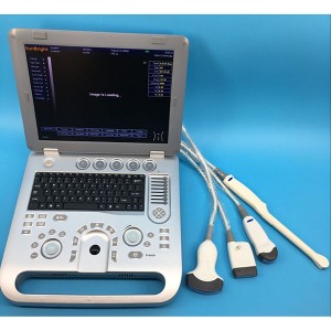 Obstetric 3D4D GYN Ultrasound SUN-800D