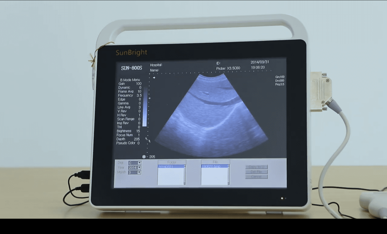 100% Original Ultrasound - Laptop Ultrasound 15  inches Touch Screen Sun-800S – Sunbright