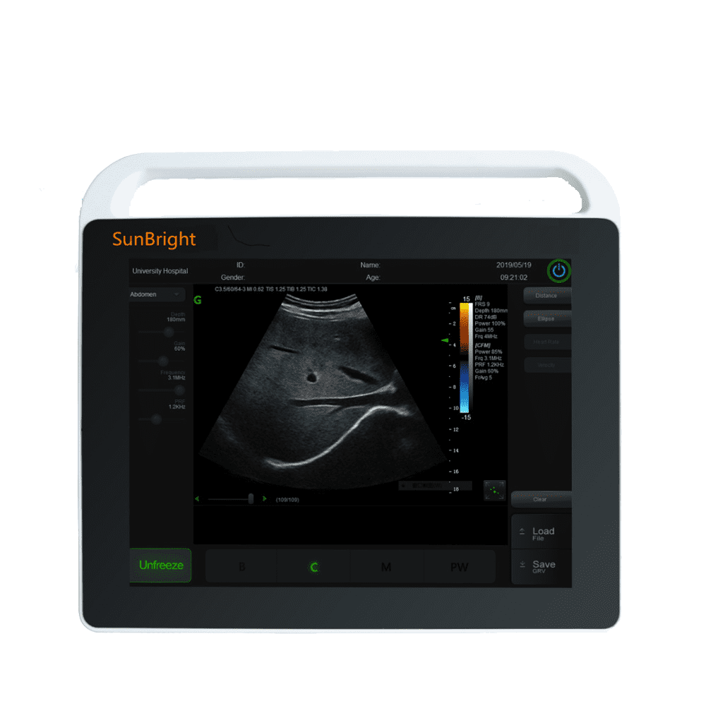 Original Factory Ultrasound Sonography - Laptop Ultrasound 15  inches Touch Screen Sun-800S – Sunbright