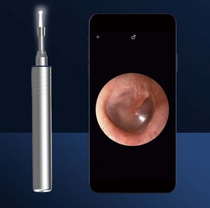 कारखाना बिक्री चीन My-F029 माया डिजिटल कोल्पोस्कोप इमेजिङ सिस्टम योनि परीक्षा कोल्पोस्कोप स्त्री रोगको लागि
