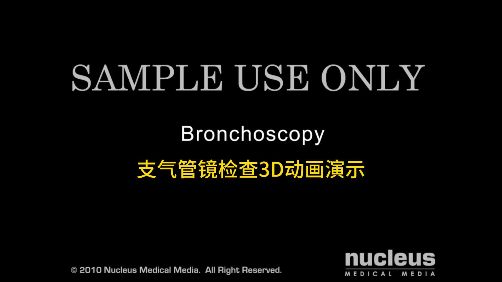 Pokażę ci, jak wygląda bronchoskopia