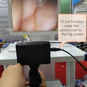 Inotakurika Vhidhiyo Ureteroscope -Flexible Endoscope