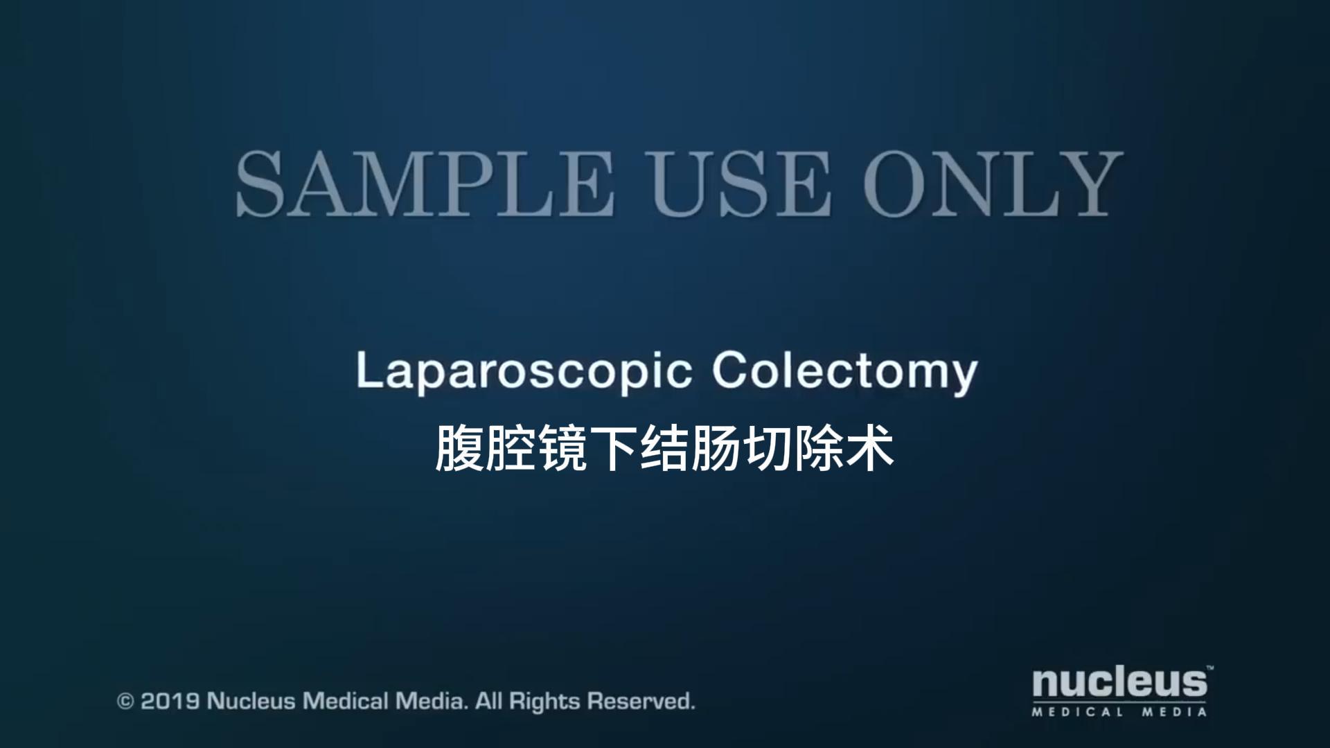 Laparoskopisk kolektomi: Minimalt invasiv metod för exakt och tydlig kirurgi