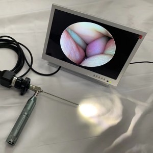 Endoskop tegar Mudah Alih Hotsale dengan monitor 10.1