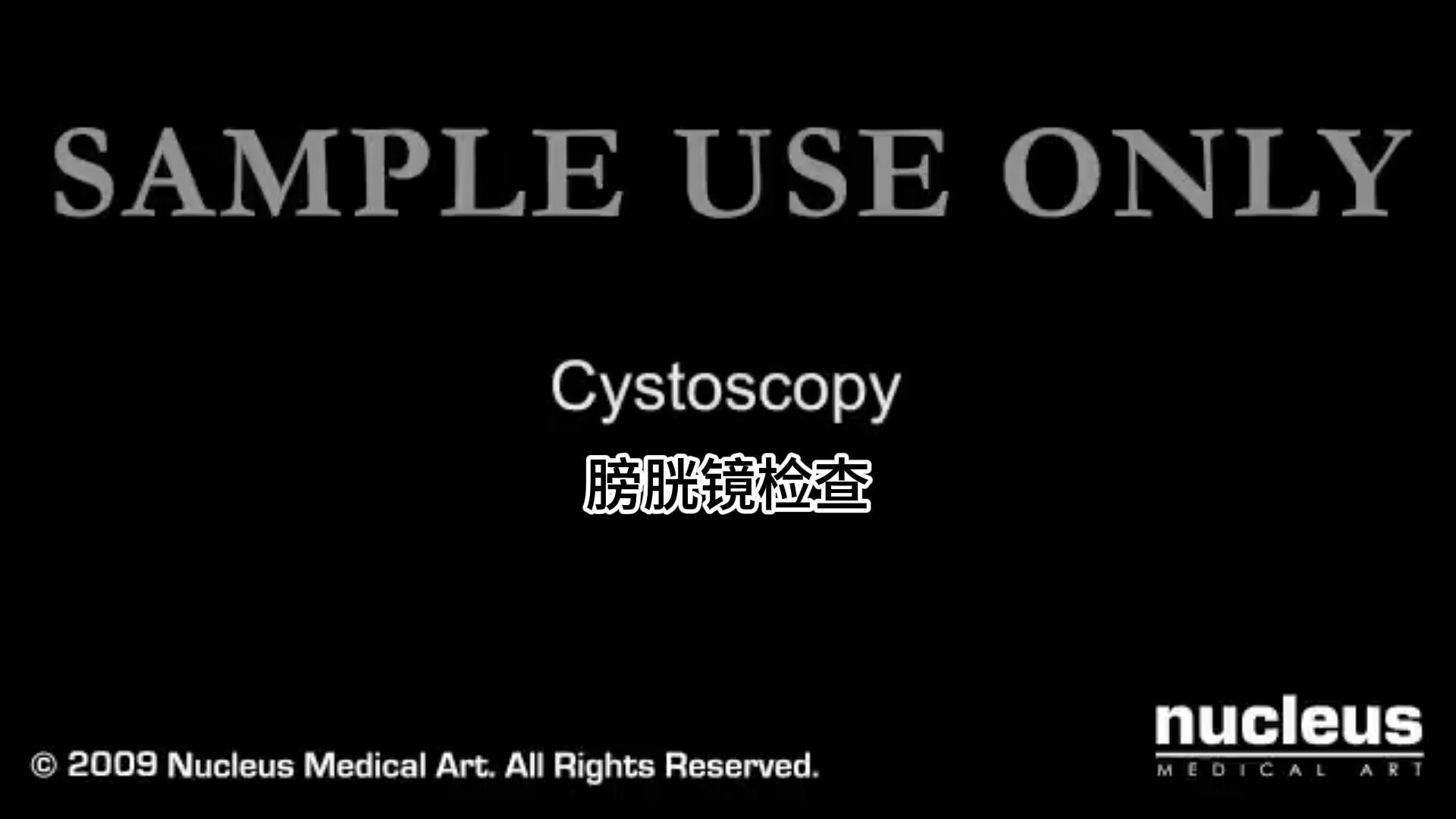 The whole process and purpose of cystoscopy