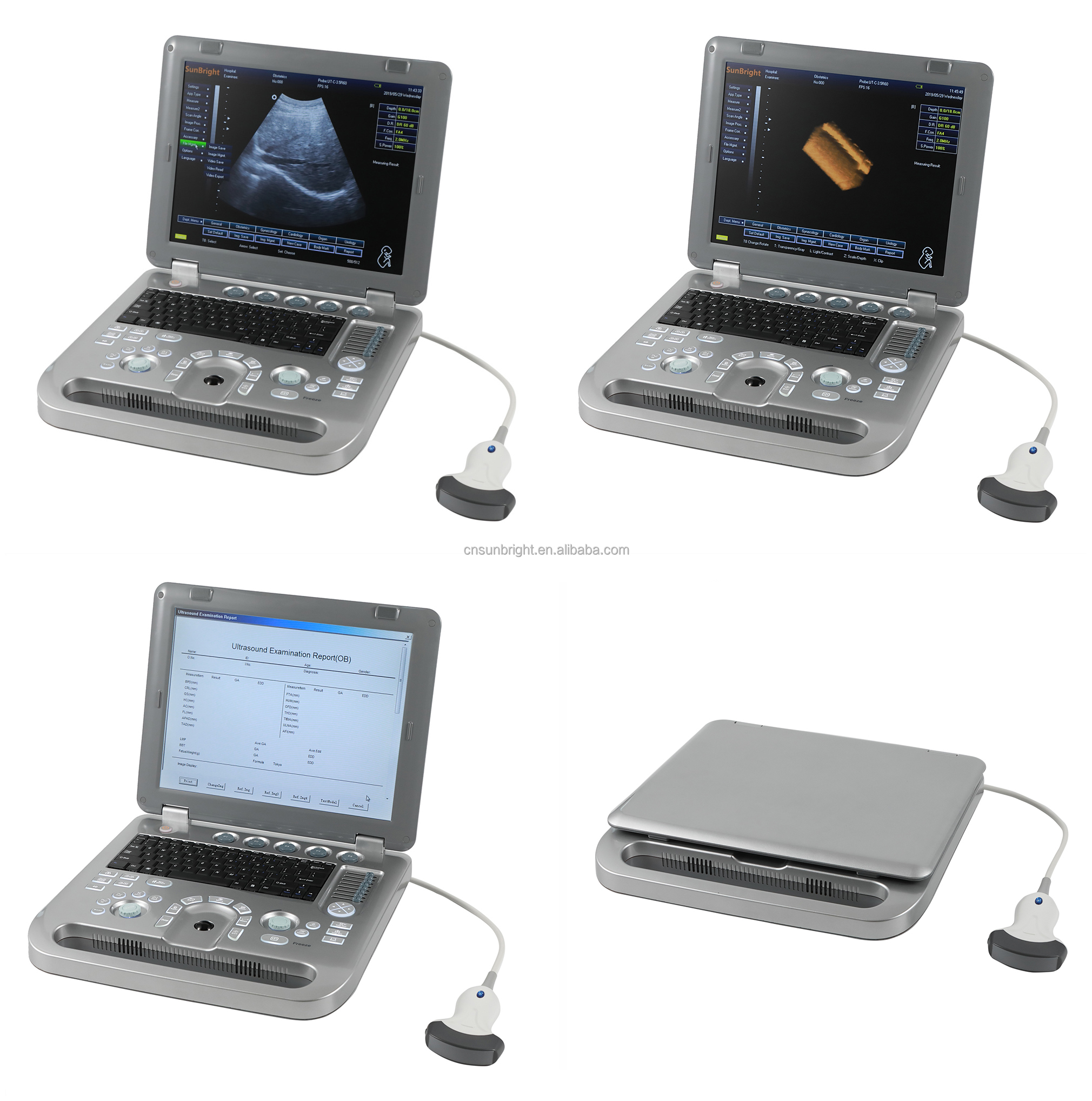 Factory Supply GDM-013 800D Kev Kho Mob Ultrasound Imaging Scanner