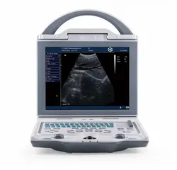 KX-5600 Notebook Gaya Medical B Mode Ultrasound Testing Piranti