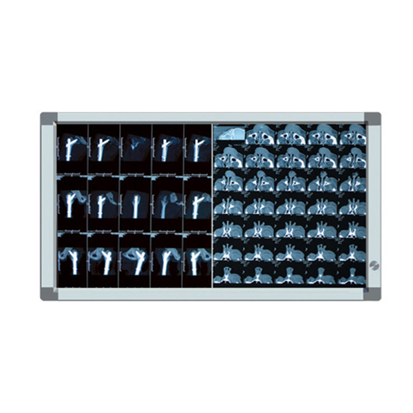 LED X ray  Box, X ray Viewer