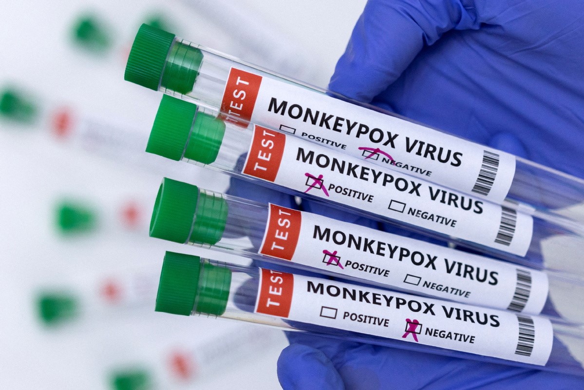 As West tries to halt monkeypox, WHO urges support for Africa to step up surveillance