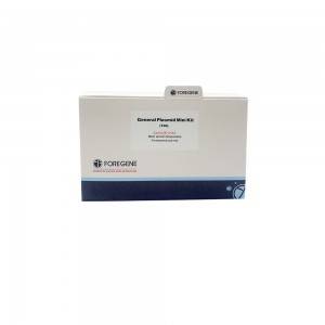 plasmid dna isolation kits room temperature operation spin column fast and easier