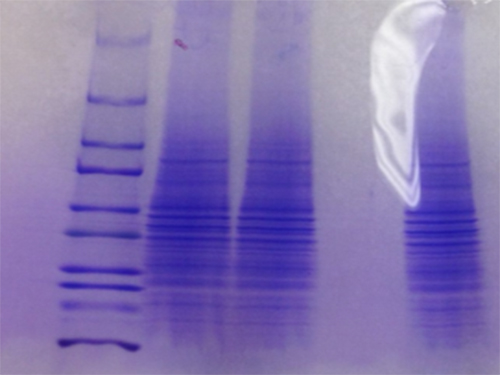 Protein Electrophoresis Common Issues