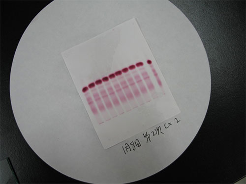 Experiment for separating serum protein by Cellulose Acetate Membrane Electrophoresis