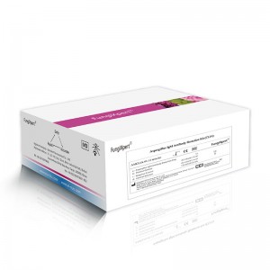 Factory Cheap SARS-CoV-2 IgG antibody - Aspergillus IgM Antibody Detection Kit (CLIA) – Genobio