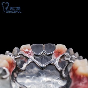 China dental design dental metal framework