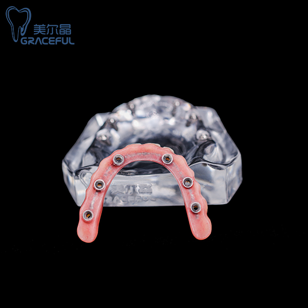 Factory wholesale Temporary Crown Tooth - Implant – Jiayi