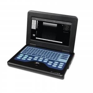 Ultrasound scanner portable ultrasound machine,Ultrasound Monitor manufacturers