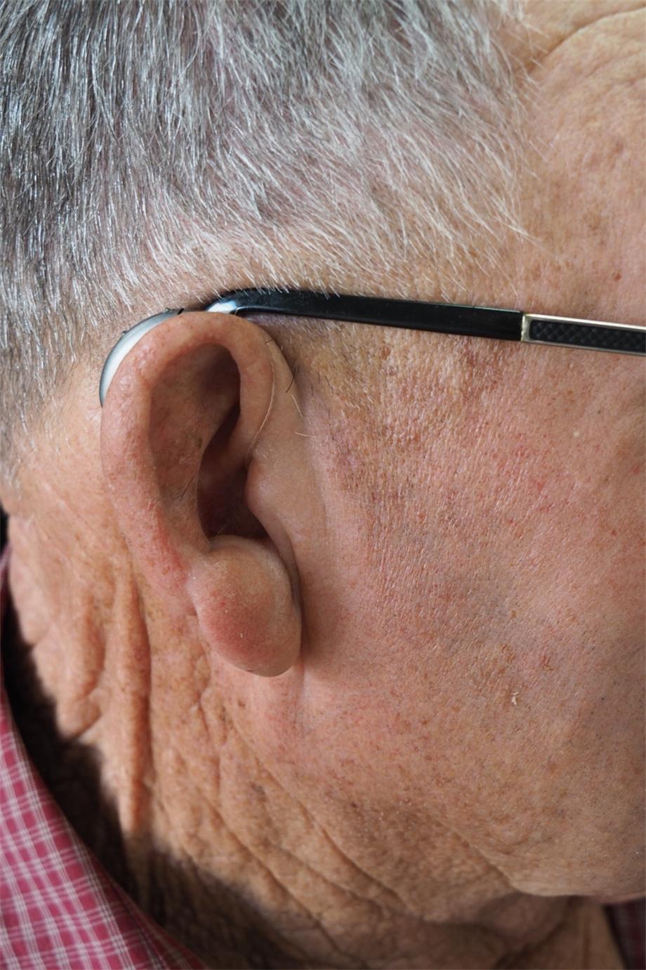 Exploring the Advantages of BTE Hearing Aids