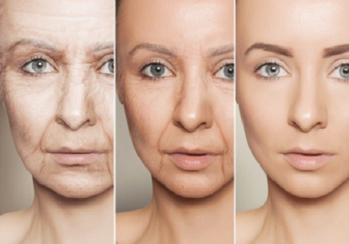 What is conotoxin? Can you remove wrinkles?