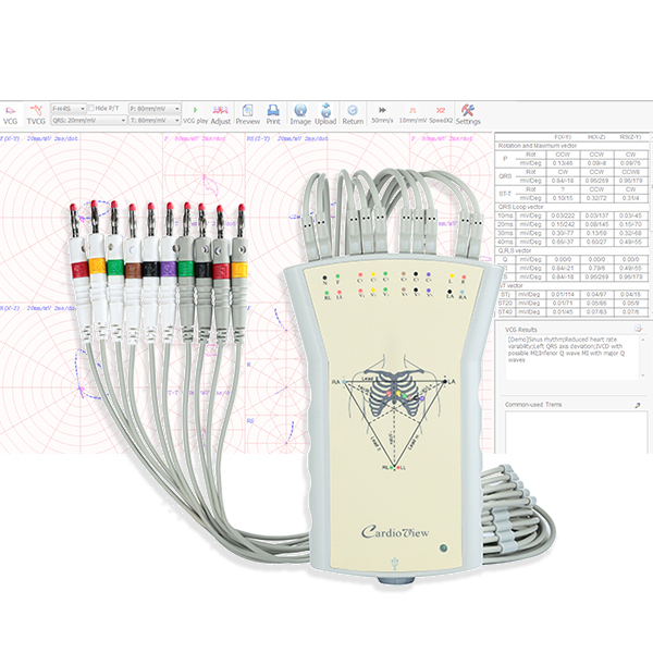 Grey Handheld ECG Machine , Portable Heart Monitoring Device With ECG Analysis Software
