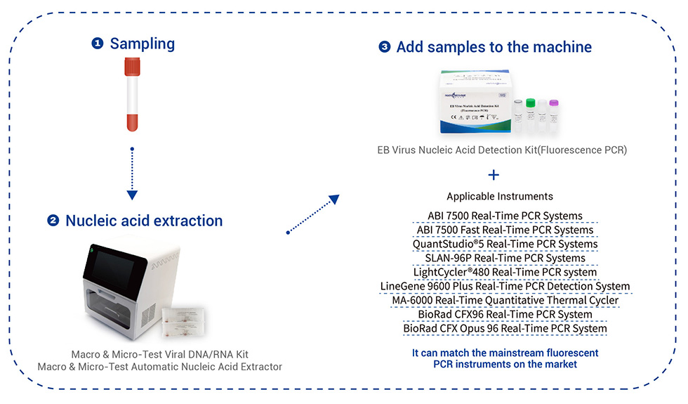 EB Virus Nucleic Acid Detection Kit : Get Quote, RFQ, Price or Buy