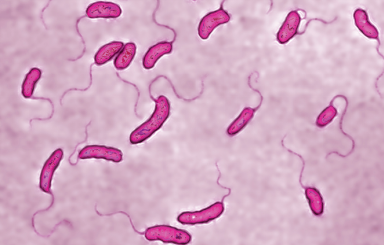 Macro & Micro-Test helps rapid screening of Cholera