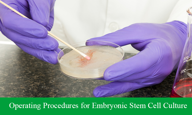 Operating Procedures for Embryonic Stem Cell Culture