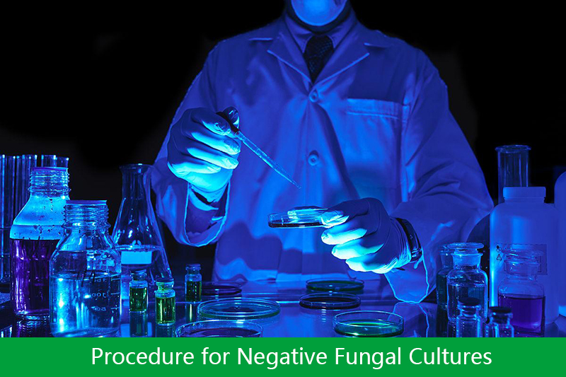 Procedure for Negative Fungal Cultures