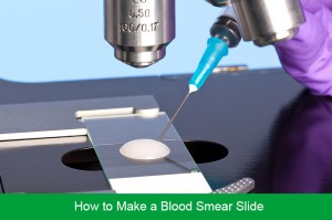 How to Make a Blood Smear Slide