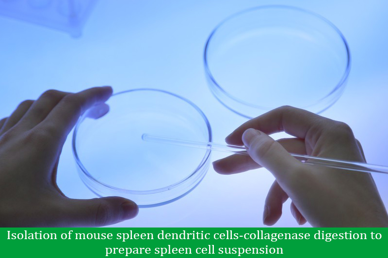 Isolation of mouse spleen dendritic cells-collagenase digestion to prepare spleen cell suspension