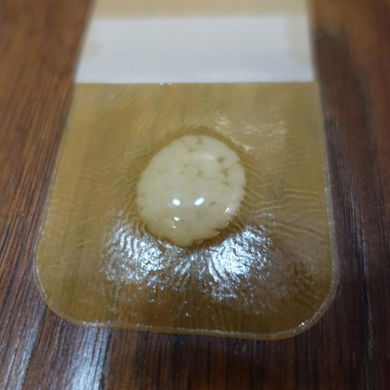 The difference between hydrogel dressing and hydrocolloid