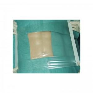 Special Price for Bordered Gauze Adhesive Island Wound Dressing - Disposable Sterile Transparent Surgical Film dressing Incision Drape Self adhesive Surgical Film –  Guangyi