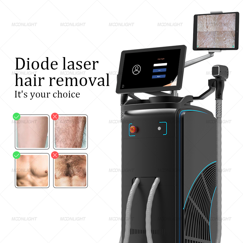 Macchina per la depilazione permanente con laser a diodi AI 808nm